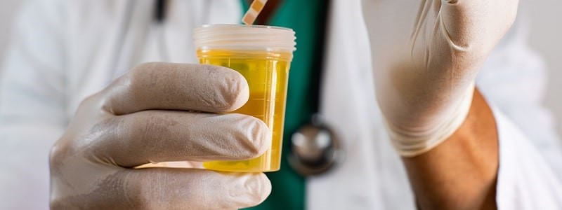 Workplace Wellbeing Urinalysis Assessment