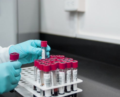 Drug testing in the workplace